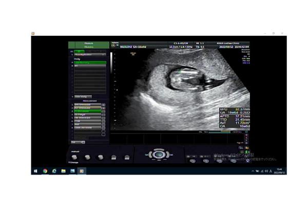 Pohlaví v 16. tt. Co myslíte?