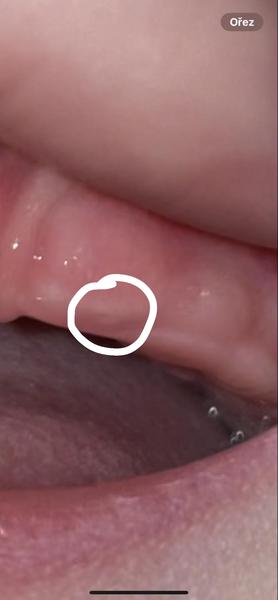 Rýma u dětí způsobená růstem zubů: Jak ji řešit?