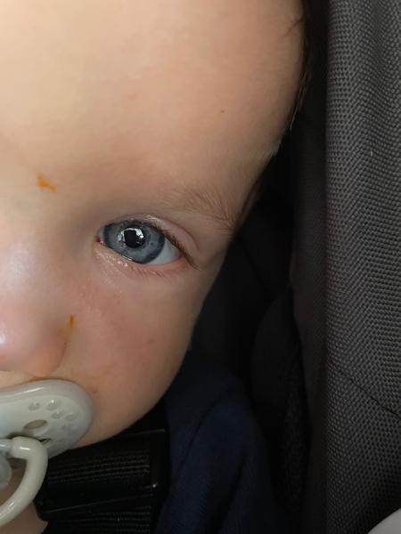 Co dělat při objevení krve v oku u dítěte?