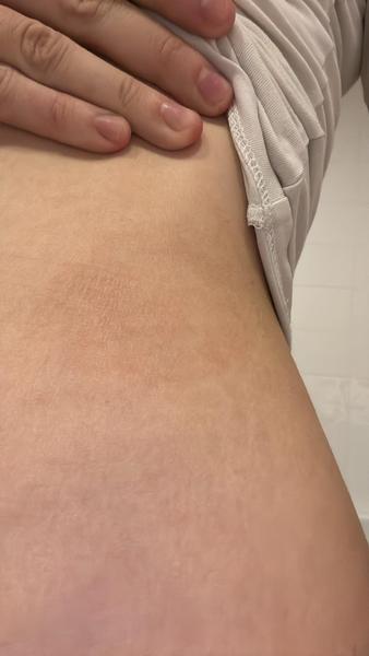 Červený flek se zvětšuje. Jak zjistit příčinu?