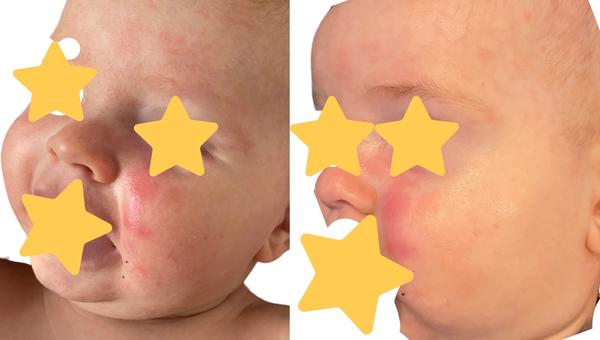 Muže to být šestá nemoc?