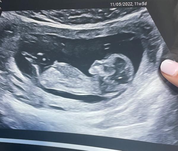 Co myslíte, čekáme chlapce nebo dívku na konci ledna?