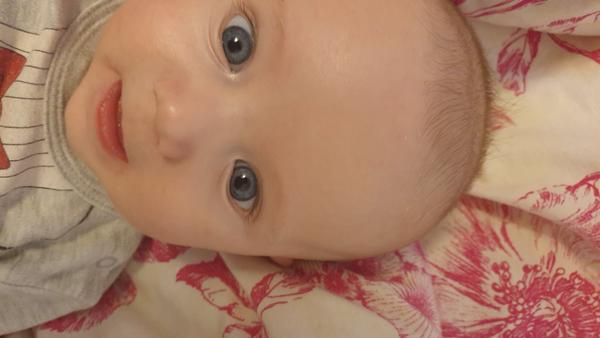 Nerovnost na pravé straně hlavičky a rozdílná velikost zorničky. Zkušenosti 🙏?