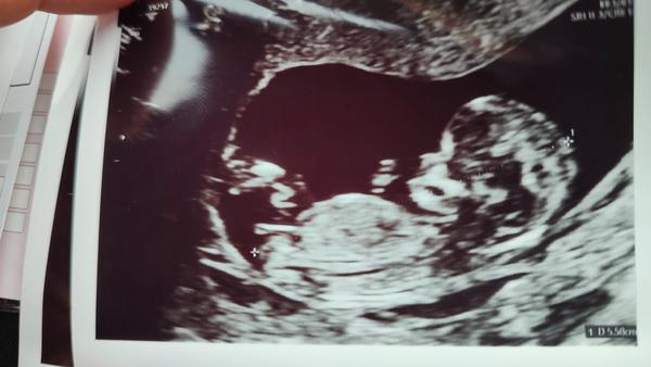 Tip na pohlaví miminka. Jaké máte názory?