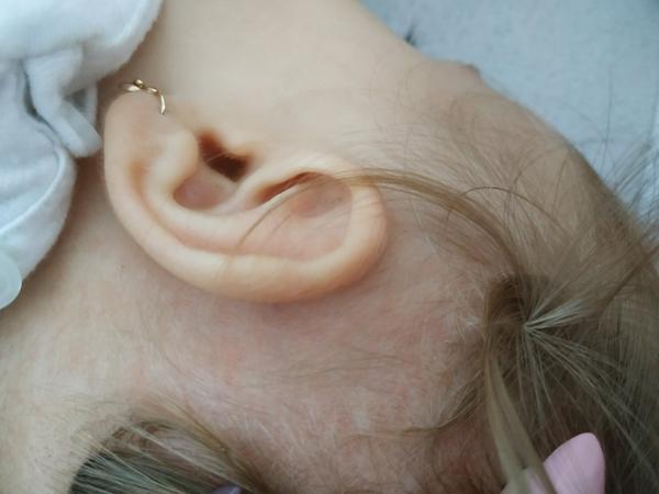 Drbání za ušima. Může to být kvůli pocení?