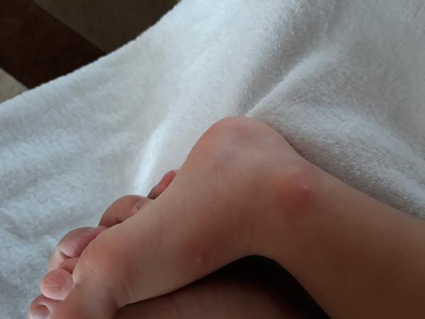 Nevíte co je to za pupínky?