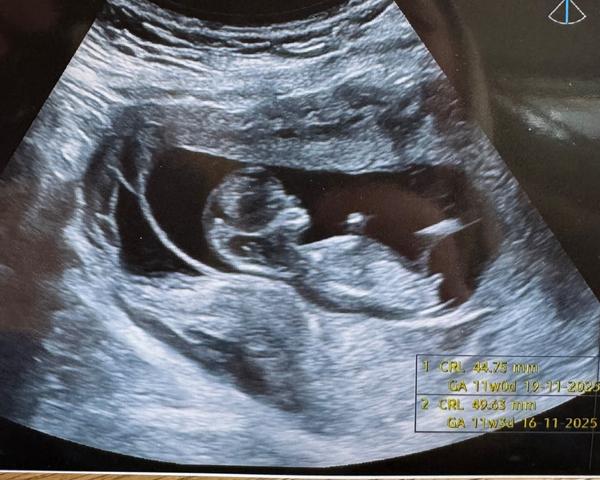 Je možné poznat pohlaví?