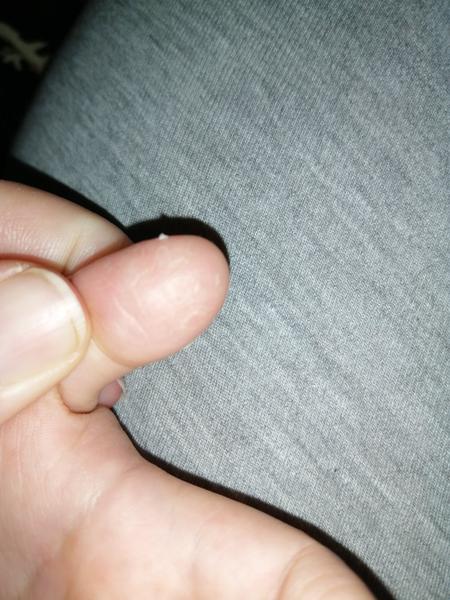 Pomoc pro dítě s popraskanými prsty před návštěvou lékaře