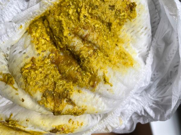 Je krev ve stolici důvodem k obavám?