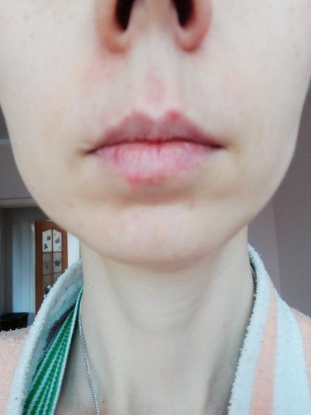 Něco na obličeji. Co to může být?