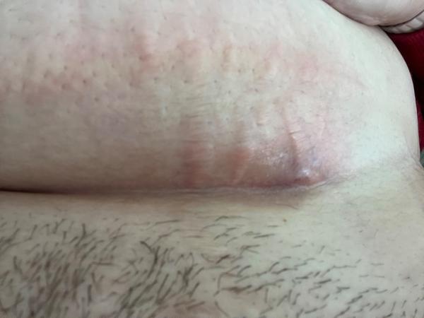 Názory na bolestivou bulku u kamarádky: Co to je?