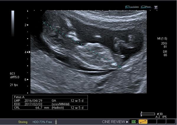 Holka nebo kluk - co myslíte? 🙂