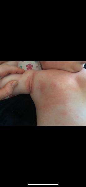 Je to kvasinka nebo něco jiného?