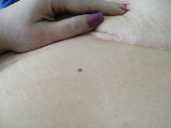 Podezřelé znaménko. Máte s takovým zkušenost?