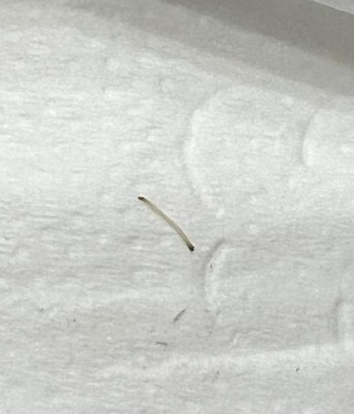 Je to parazit? Podezřelý nález na toaletním papíru