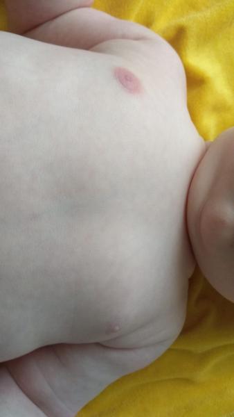 Červené prso u 5měsíčního syna