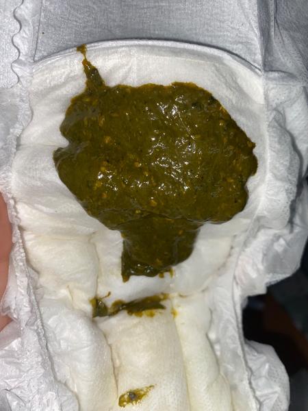 2měsíční miminko - problém s UM. Je takové vyprazdňování v pořádku?