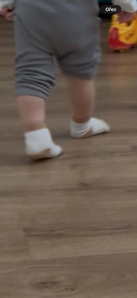 Jak řešit vytáčení nohy u dítěte?