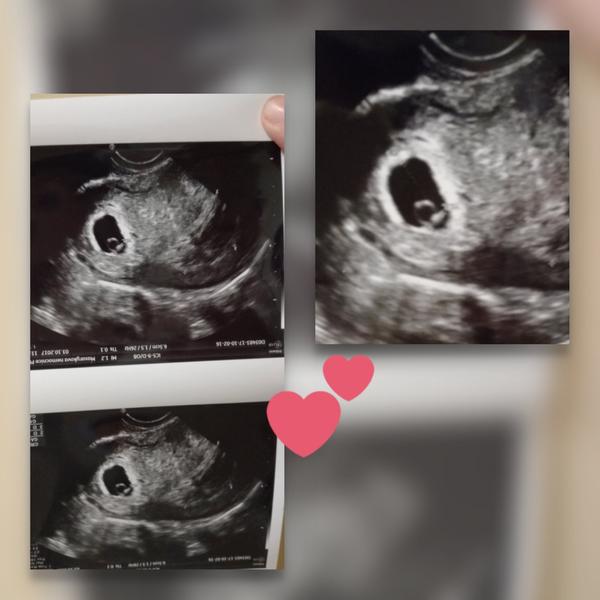 Jeden doktor říká v 5. týdnu, jiný v 6.