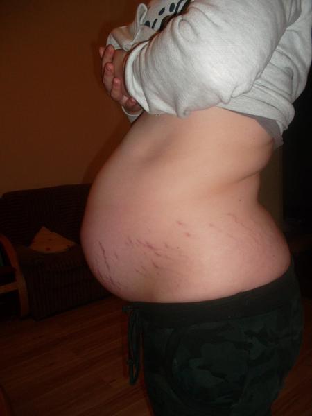 Břicho mi jde ve 32tt čím dál tím víc dolů, poraďte