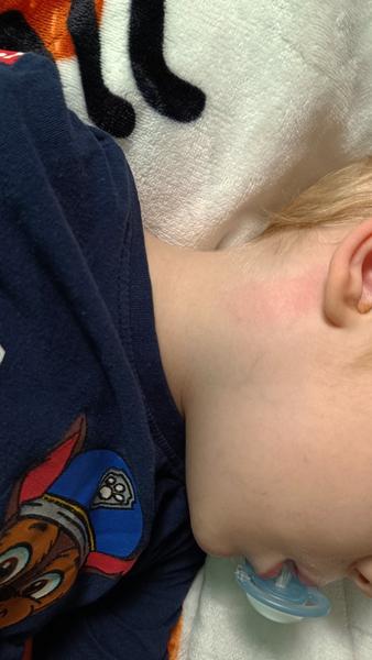 Boule na krku u čtyřletého. Je to zánět?