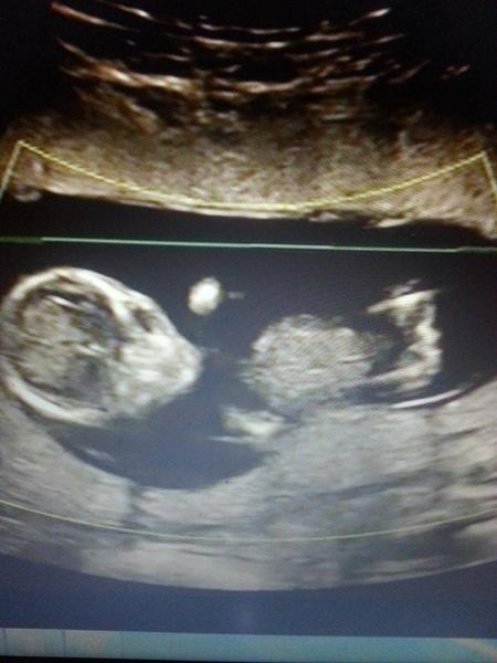 Poznáte pohlaví ve 14. týdnu těhotenství?