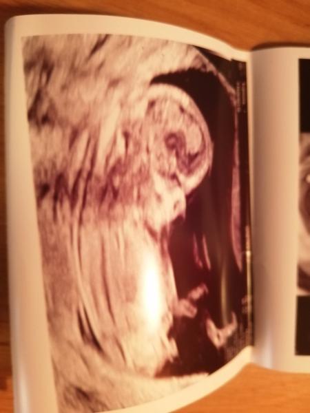 Pohlaví. Čekáme holčičku nebo chlapečka?