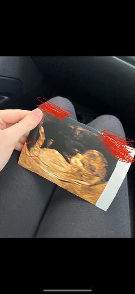 Je možné podle ultrazvuku ve 13. týdnu poznat pohlaví?