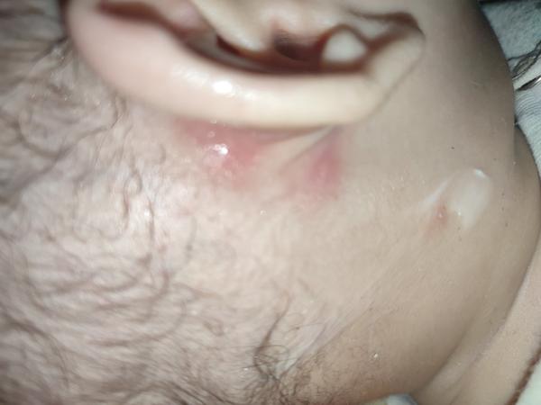 Vyrážka. Co by to mohlo být?