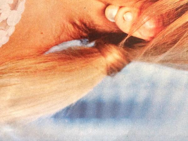 Cop utažený pramenem vlasů, jak postupovat?