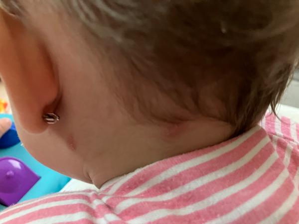 Pupínky. Co by to mohlo být?