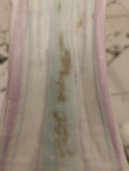 Krvavý hlen. Čím to může být?