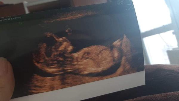 Screening 16.tt. Co myslíte, že budu mít?