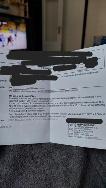 Bulka v prsu. Je to podle zprávy zhoubný nádor?