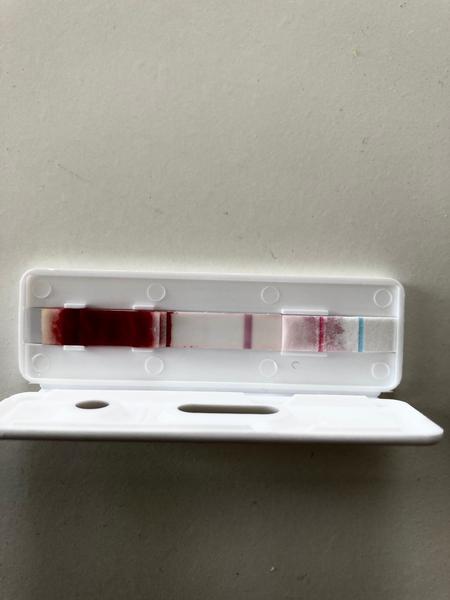 Test štítná žláza. Brát jako pozitivní?