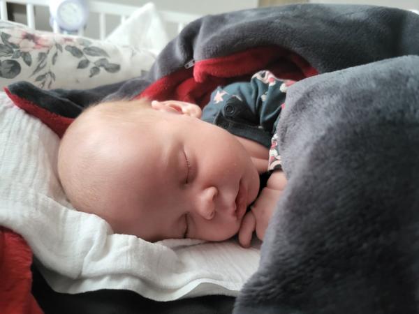 Skafocefalie u dětí. Je důvod k obavám?