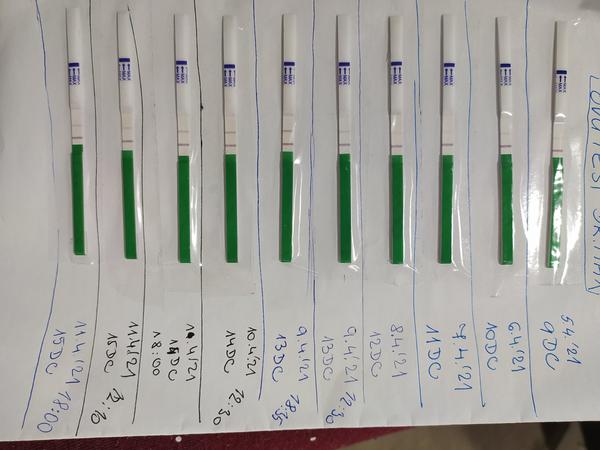 Prosím, poradíte mi s ovu a BT grafem?