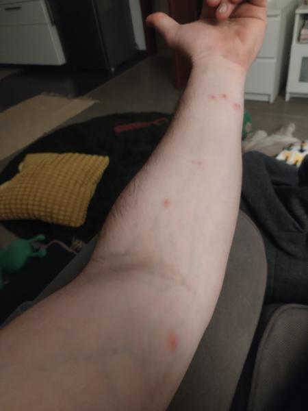 Od čeho může být kousnutí?