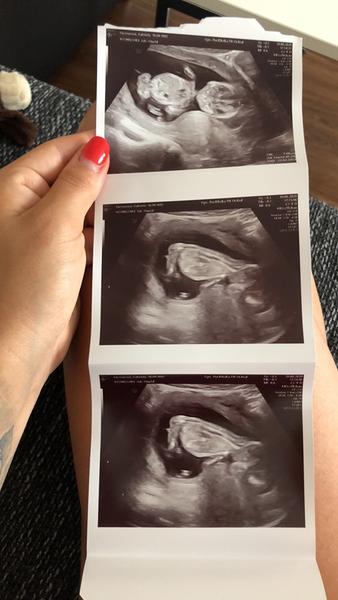 Holčička nebo chlapeček?👶🏼