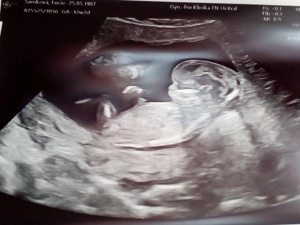 Holka nebo kluk. Pozná tady někdo na 100 %?