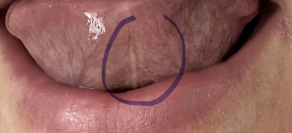 Co se nachází pod vaším jazykem?