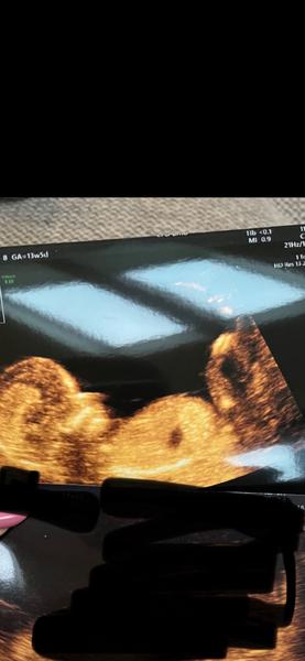 Lze určit pohlaví?