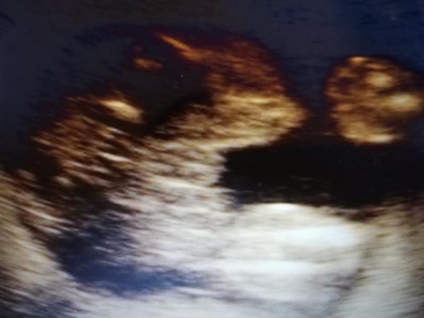 Pohlaví miminka. Poznáte někdo z fotky?