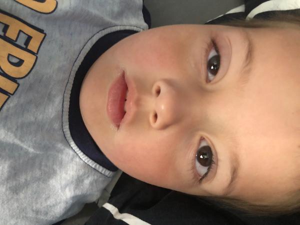 Nateklé oko. Co by to mohlo být? Zajít raději k lékaři?