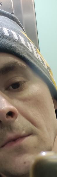 Otok pod pravým okem. V čem by mohl být problém?