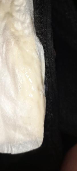 Je to hlenová zátka?