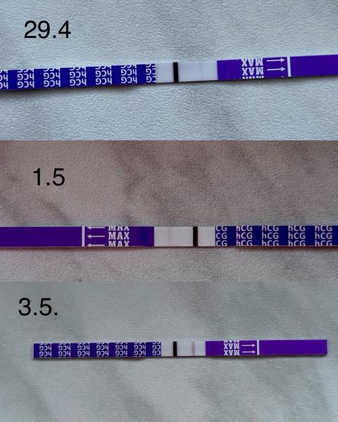 Bolest břicha. Může to být příznak těhotenství?