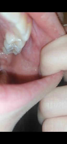 Moučnivka. Které léky opravdu zabírají?