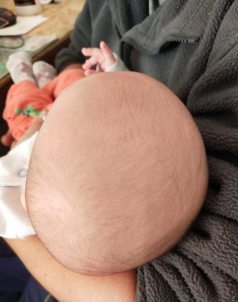 Slehlá hlavička u novorozence. Zakulatí se sama?