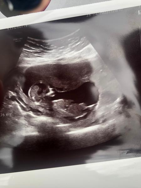 Poznáte prosím pohlaví?